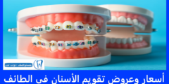 أسعار تقويم الأسنان في الطائف 2025 + عروض تقويم الأسنان الطائف