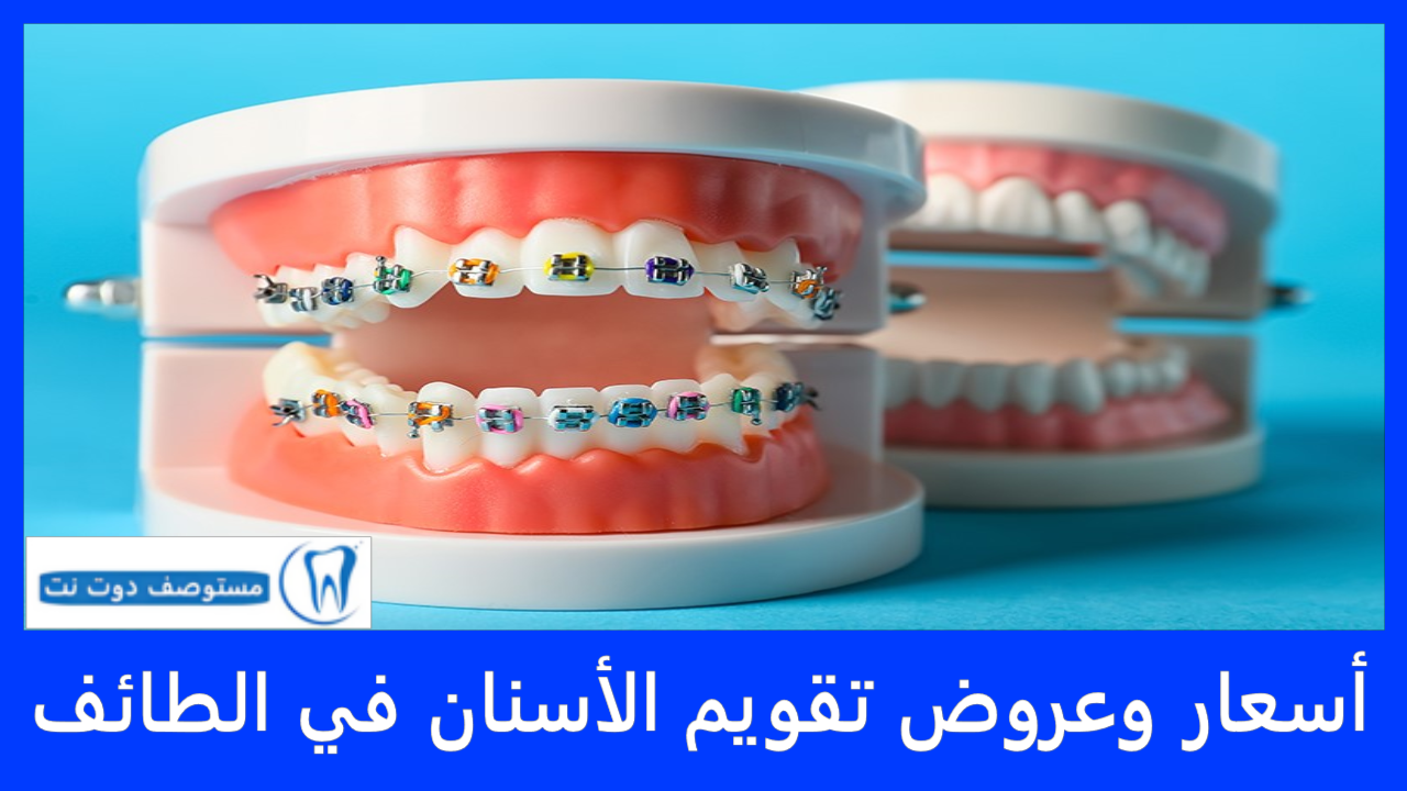 أسعار تقويم الأسنان في الطائف