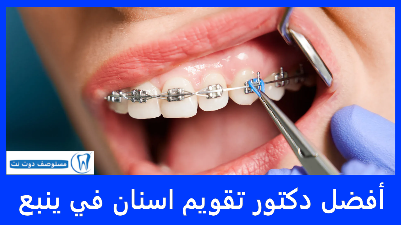 أفضل دكتور تقويم اسنان في ينبع