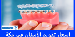 اسعار تقويم الأسنان في مكة 50%- ارخص تقويم اسنان في مكة