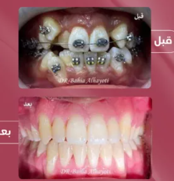 د. بهية الحيوتي – أخصائية تقويم الأسنان في مكة المكرمة