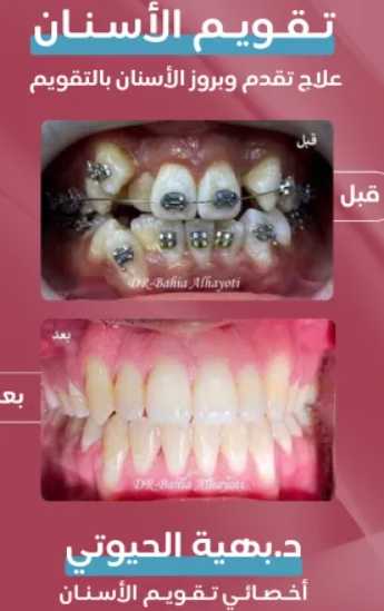 د. بهية الحيوتي – أخصائية تقويم الأسنان في مكة المكرمة