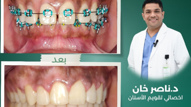 د. ناصر خان – أخصائي تقويم الأسنان في الأحساء