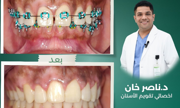 د. ناصر خان – أخصائي تقويم الأسنان في الأحساء