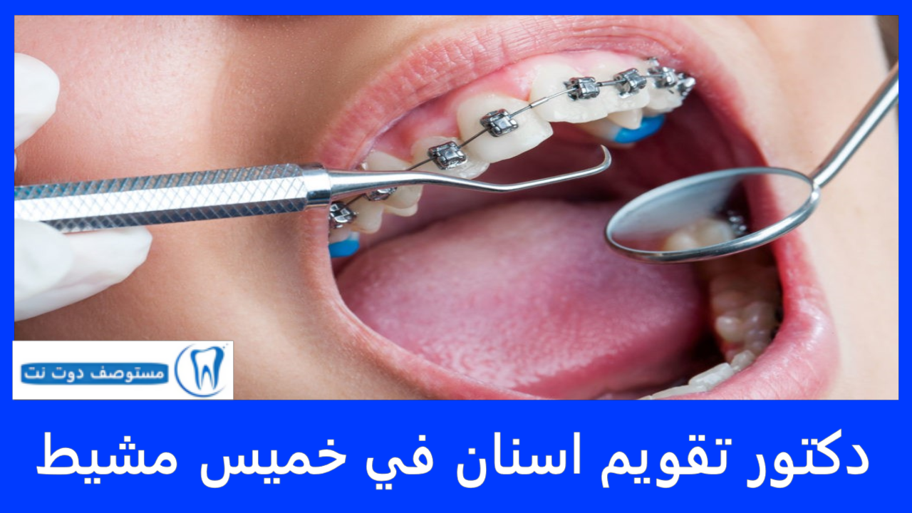 افضل دكتور تقويم اسنان في خميس مشيط