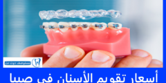 أسعار تقويم الأسنان في صبيا + ارخص وافضل العروض