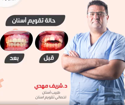 الدكتور شريف مهدي - أخصائي تقويم الأسنان في حائل