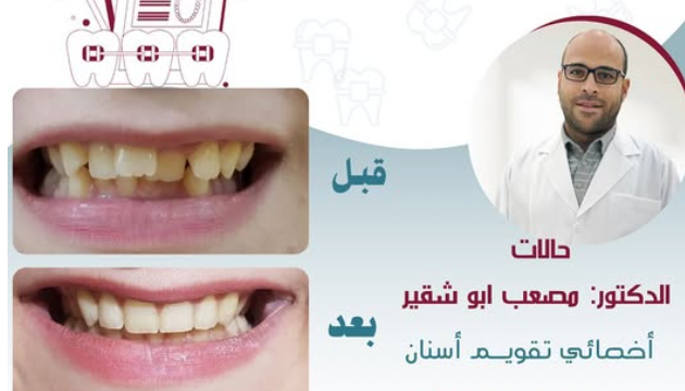 الدكتور مصعب أبو شقير – أخصائي تقويم الأسنان في نجران