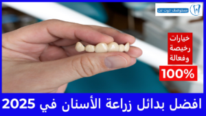 بدائل زراعة الأسنان
