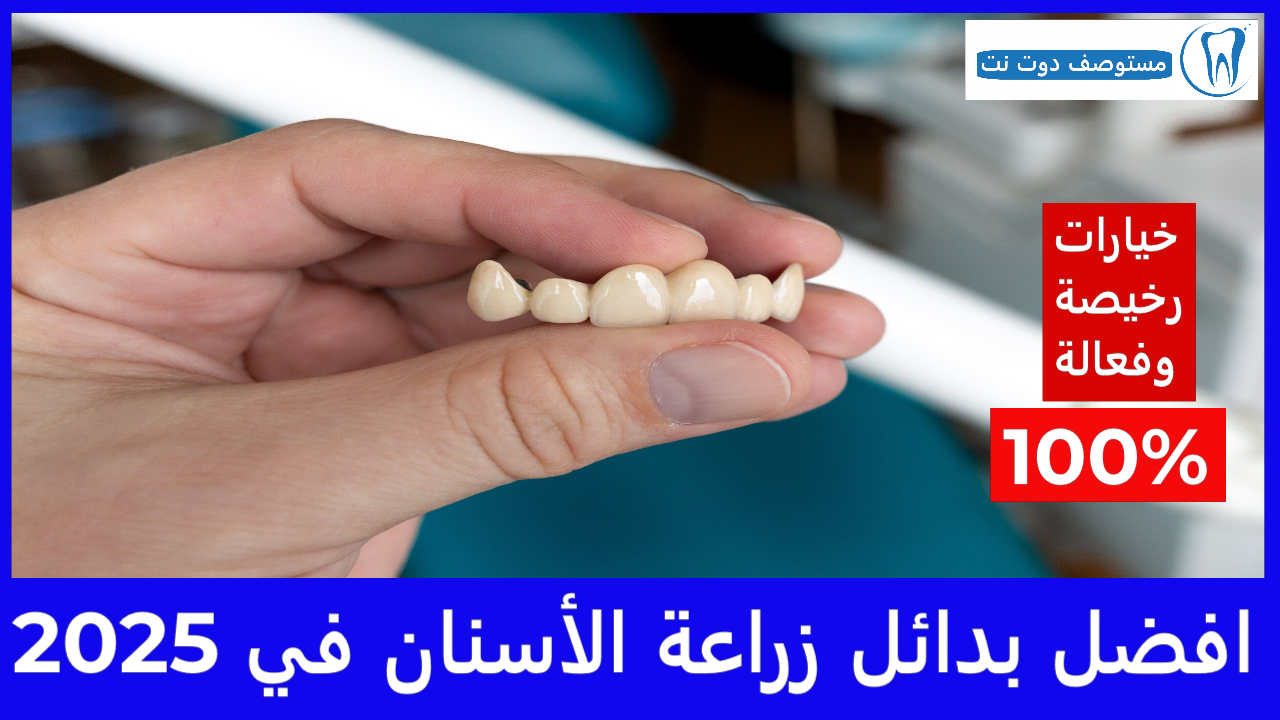 بدائل زراعة الأسنان