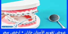عروض تقويم الأسنان جازان 2025 + ارخص سعر
