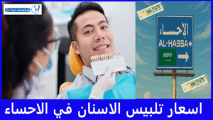 اسعار تلبيس الاسنان في الاحساء