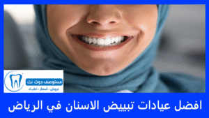افضل عيادات تبييض الاسنان في الرياض