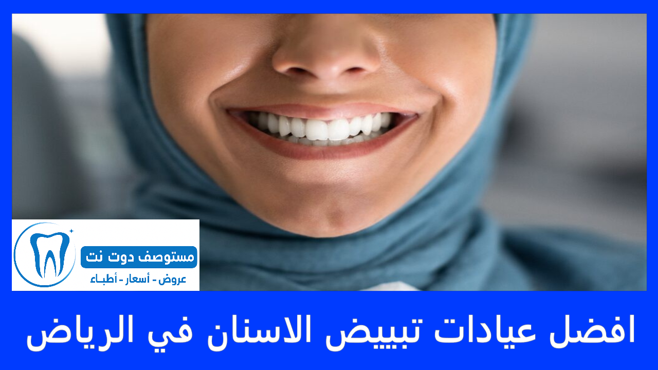 افضل عيادات تبييض الاسنان في الرياض