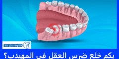 بكم خلع ضرس العقل في المهيدب؟