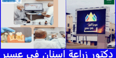 افضل 10 دكتور زراعة اسنان في عسير – لا تفوّت القائمة!