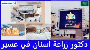 افضل دكتور زراعة اسنان في عسير
