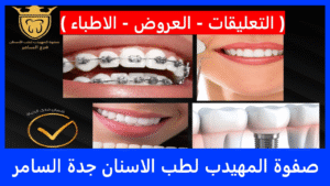 صفوة المهيدب لطب الاسنان جدة السامر