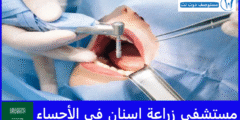 أفضل 9 مستشفى زراعة اسنان في الأحساء خاص وحكومي