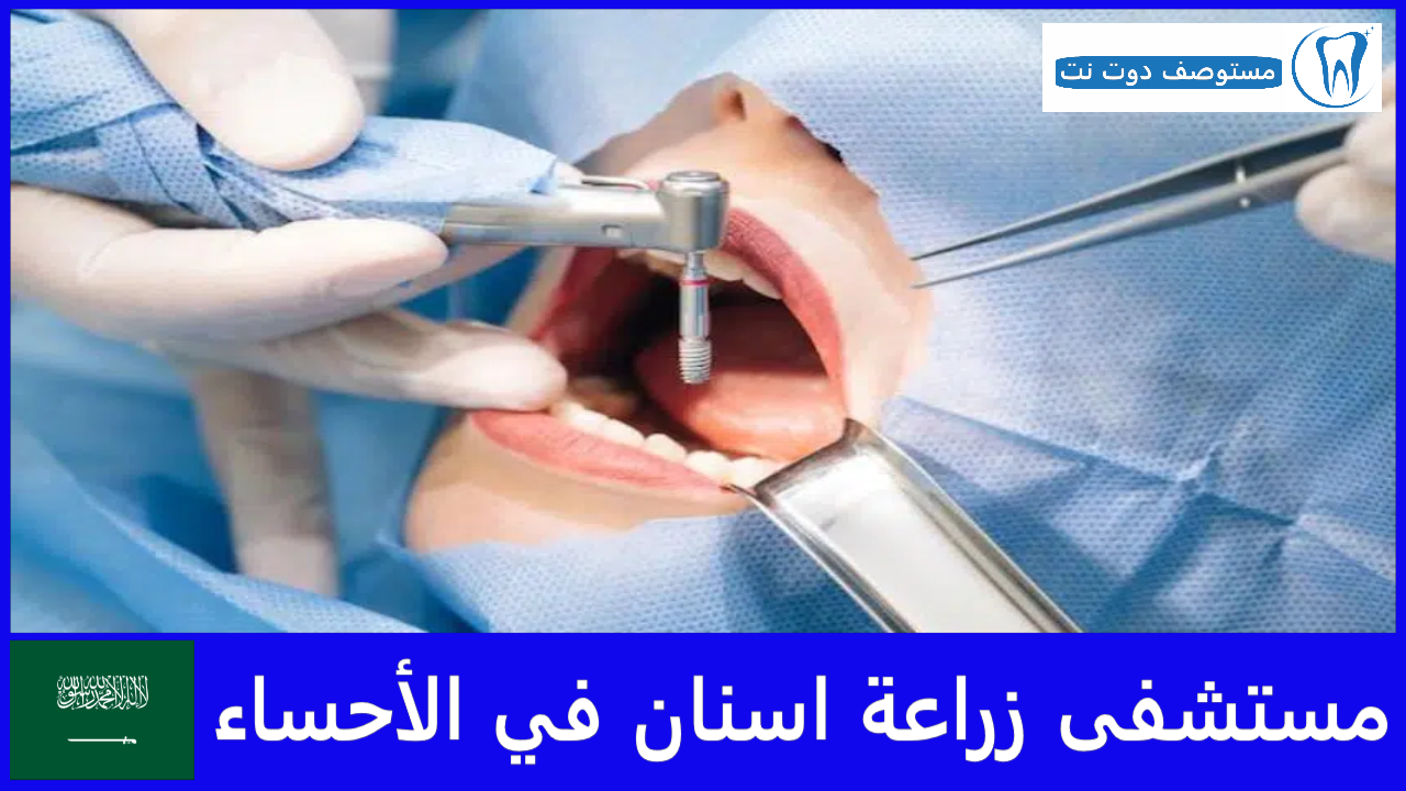 مستشفى زراعة اسنان في الأحساء