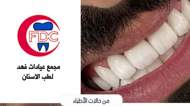 مستوصف مركز فهد لطب الأسنان في الرياض