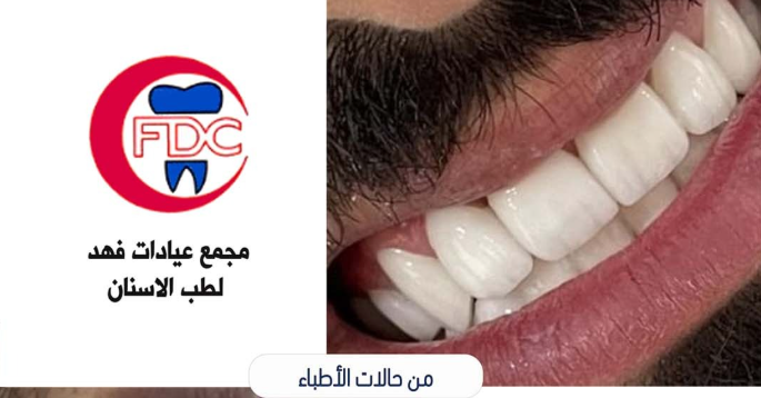 مستوصف مركز فهد لطب الأسنان في الرياض