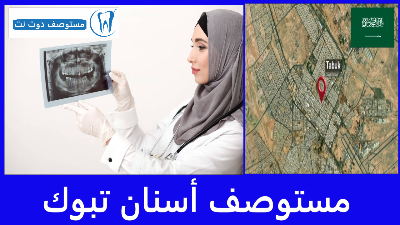 افضل 10 مستوصف أسنان تبوك الأعلى تقييما والأرخص