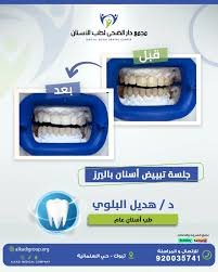 الدكتورة هديل البلوي طبيبة اسنان عامة في دار الضحى تبوك