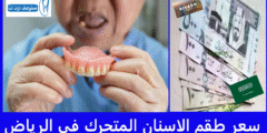 أفضل 4 أماكن توفر أرخص سعر طقم الاسنان المتحرك في الرياض