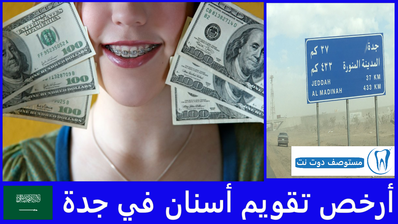 أرخص تقويم أسنان في جدة
