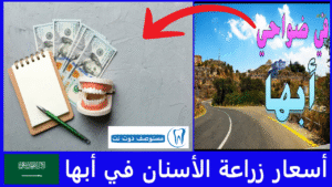 أسعار زراعة الأسنان في أبها