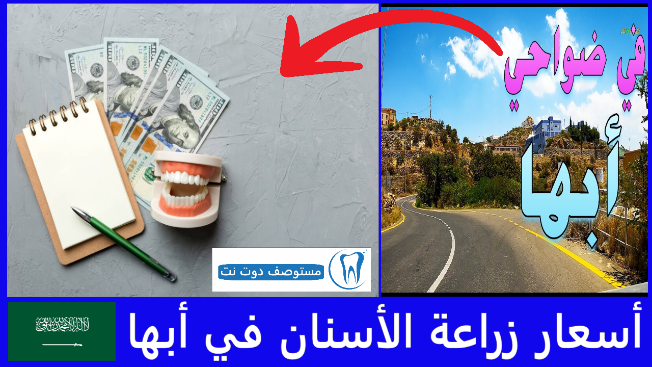 أسعار زراعة الأسنان في أبها