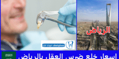 ارخص اسعار خلع ضرس العقل بالرياض 7 عيادات تستحق التجربة