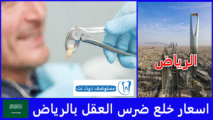 ارخص اسعار خلع ضرس العقل بالرياض