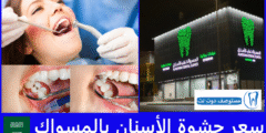 سعر حشوة الأسنان بالمسواك في أكثر 93 فرعا بالمملكة