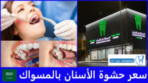 سعر حشوة الأسنان بالمسواك