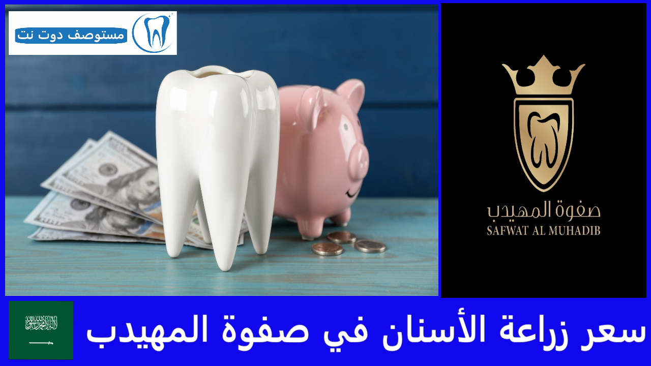 سعر زراعة الأسنان في صفوة المهيدب