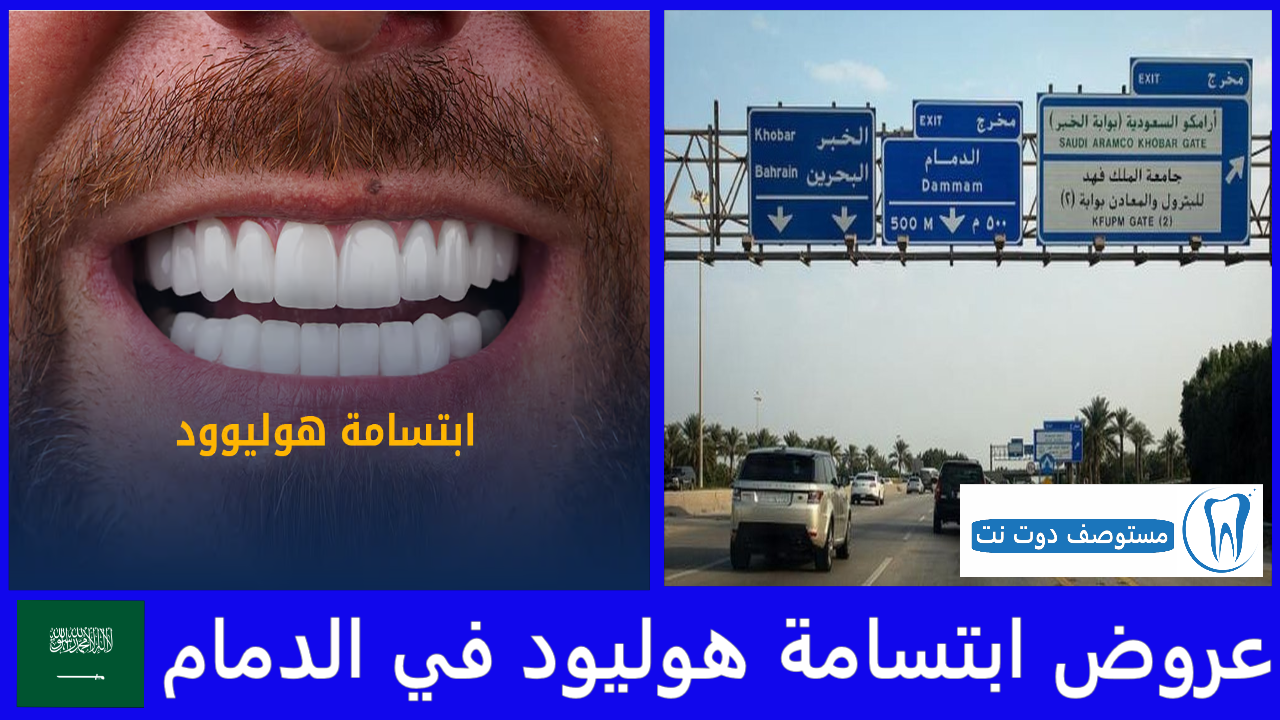 عروض ابتسامة هوليود في الدمام