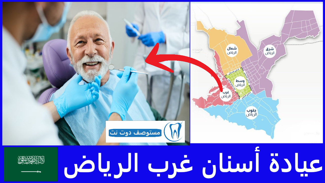 افضل عيادة أسنان غرب الرياض
