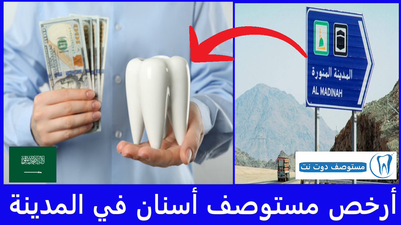 أرخص مستوصف أسنان بالمدينة