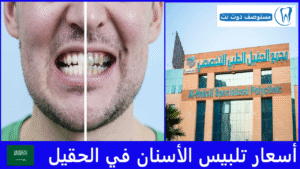 أسعار تلبيس الأسنان في الحقيل