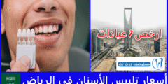 أسعار تلبيس الأسنان في الرياض | ارخص 7 عيادات