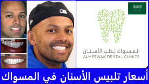 أسعار تلبيس الأسنان في المسواك
