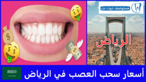 أسعار سحب العصب في الرياض