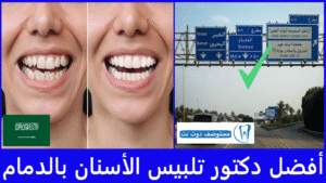 أفضل دكتور تلبيس الأسنان بالدمام