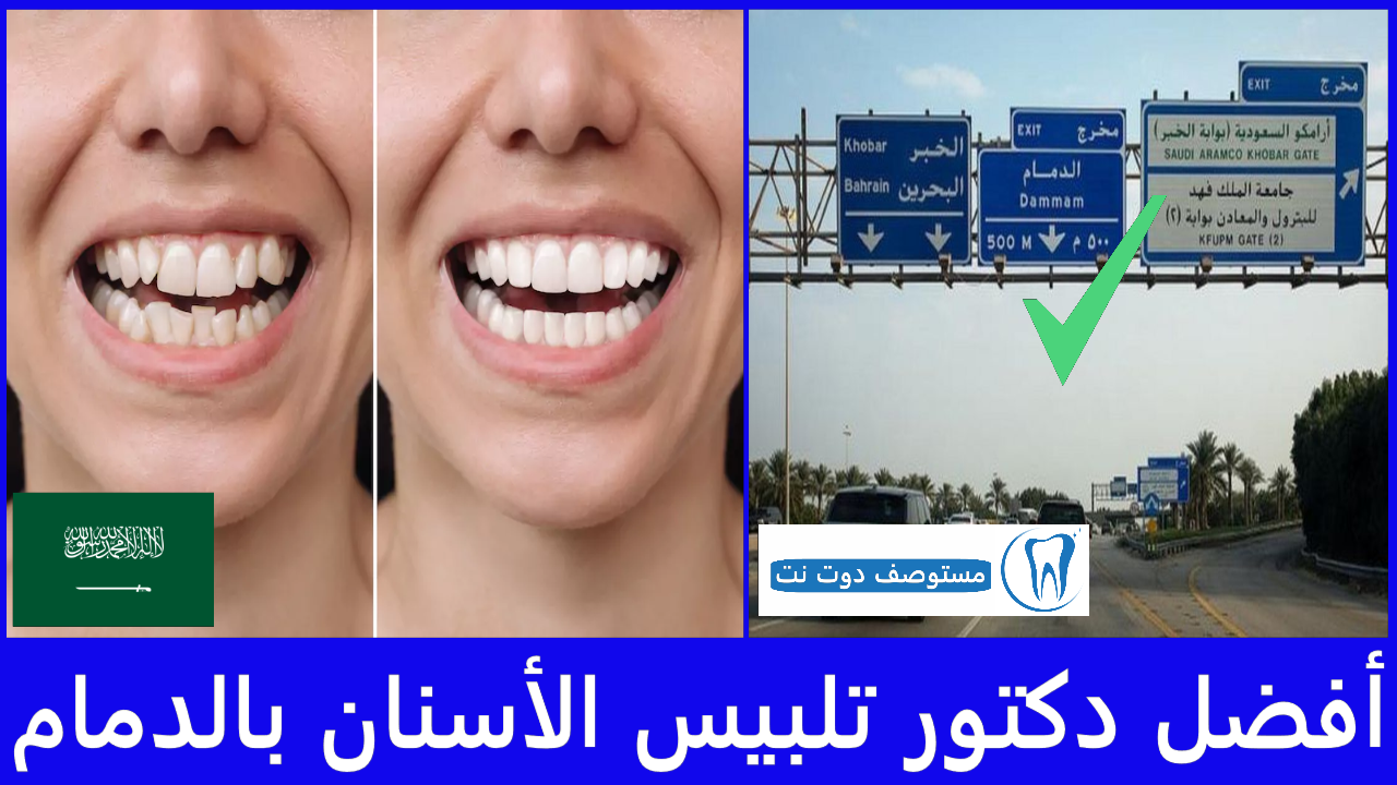 أفضل دكتور تلبيس الأسنان بالدمام