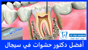 أفضل دكتور حشوات في سيجال