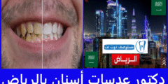 أفضل 10 دكتور عدسات أسنان بالرياض عن تجربة