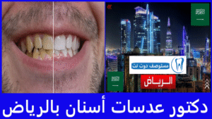 أفضل دكتور عدسات أسنان بالرياض
