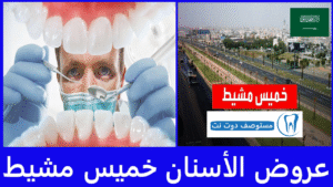 أفضل عروض الأسنان خميس مشيط